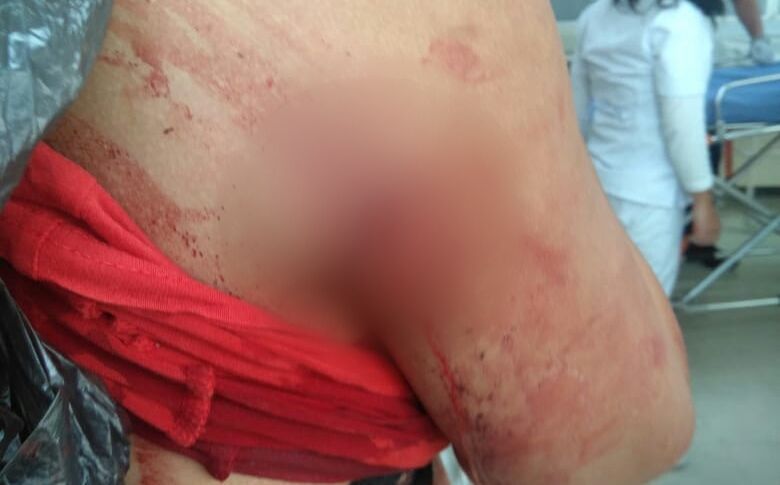 Iztacalco: balean a dos mujeres y dos menores en la INPI Picos