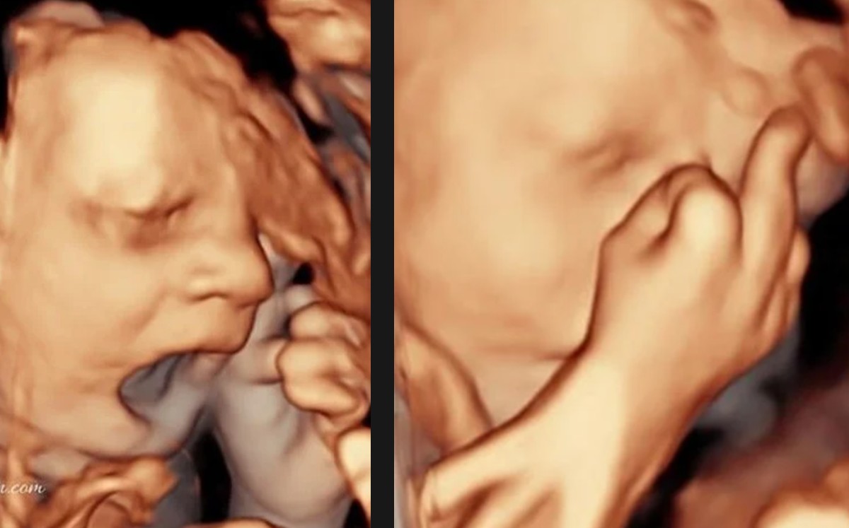 Inglaterra Pareja Senal Grosera De Bebe El Vientre Ecografia 4d