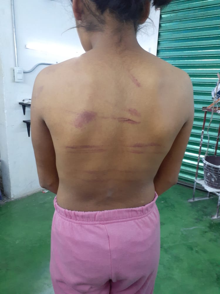 Ya recibe además de atención psicológica y tratamiento médico.