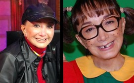 La Chilindrina habló de sus tumores en los senos tras vendarse el busto por años. (Instagram)