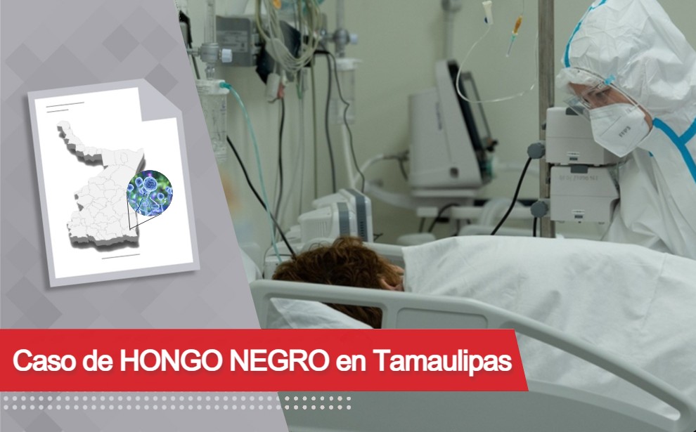 Hongo negro en Tamaulipas, detectan primer caso en una mujer